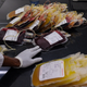 A health care worker arranging packs of donated blood at a blood transfusion clinic.